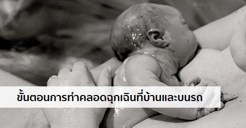 การคลอดฉุกเฉิน (คลอดกะทันหัน) รับมืออย่างไร ?