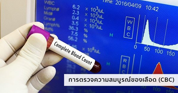 การตรวจความสมบูรณ์ของเม็ดเลือด (Complete Blood Count : CBC)