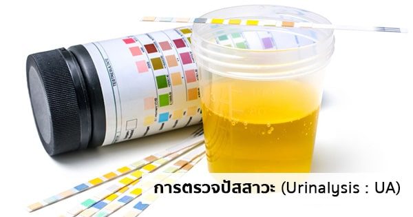 การตรวจปัสสาวะ (Urinalysis หรือ Urine analysis : UA) มีประโยชน์อย่างไร ?