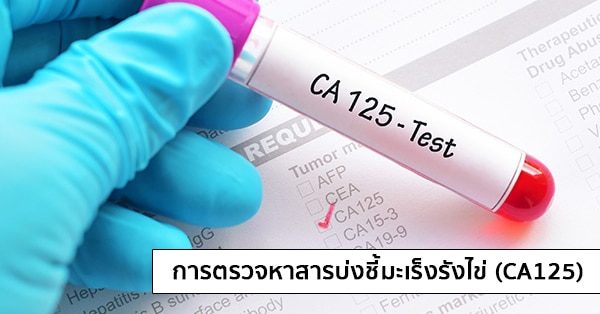 การตรวจหาสารบ่งชี้มะเร็งรังไข่ (CA125 : Cancer Antigen 125)