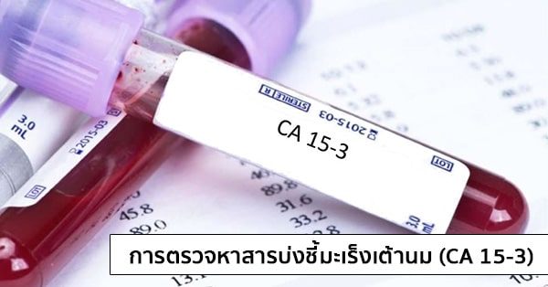 การตรวจหาสารบ่งชี้มะเร็งเต้านม (CA 15-3 : Cancer Antigen 15-3)