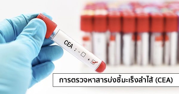 การตรวจหาสารบ่งชี้มะเร็งลำไส้ (CEA : Carcinoembryonic Antigen)