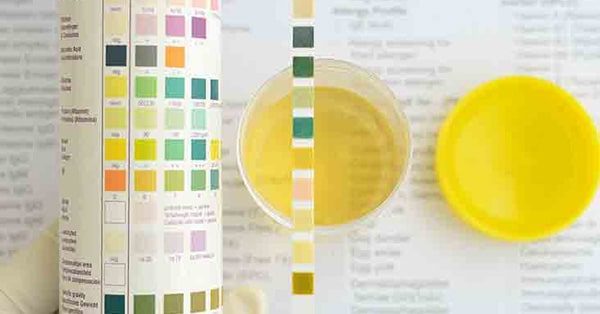 ค่าความเป็นกรด-ด่างของปัสสาวะ (urine pH หรือ pH) คืออะไร ?