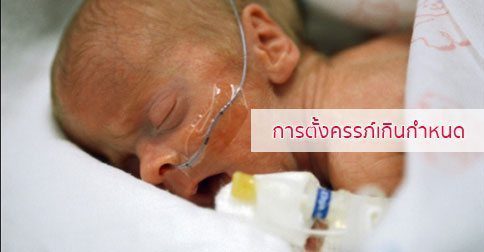 การตั้งครรภ์เกินกำหนด : สาเหตุ การรักษา และวิธีป้องกัน ฯลฯ
