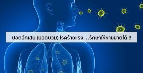 ปอดอักเสบ (ปอดบวม) อาการ สาเหตุ การรักษาโรคปอดอักเสบ 5 วิธี !!