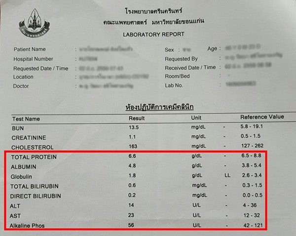 ผลการตรวจการทำงานของตับ