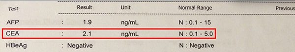 ผลการตรวจมะเร็งลำไส้ใหญ่