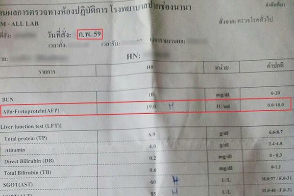ผลการตรวจหาสารบ่งชี้มะเร็งตับ