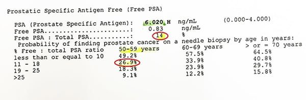 ผลตรวจ Free PSA