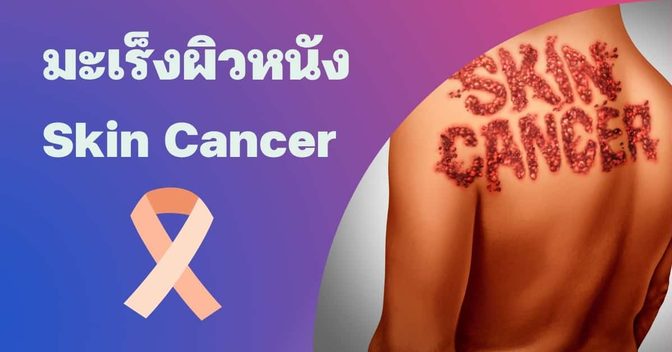 มะเร็งผิวหนัง (Skin cancer) อาการ, สาเหตุ, การรักษา ฯลฯ