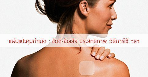 แผ่นแปะคุมกำเนิด : 11 ข้อดี-ข้อเสียของยาคุมกำเนิดแบบแปะ !!