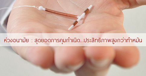 ห่วงอนามัย : 12 ข้อดี-ข้อเสีย & การใส่ห่วงอนามัย (ห่วงคุมกำเนิด) !