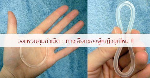 วงแหวนคุมกําเนิด : 12 ข้อดี-ข้อเสียของวงแหวนคุมกำเนิด !!