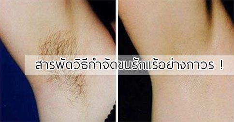 10 วิธีกําจัดขนรักแร้ ให้สิ้นซากอย่างถาวร !!
