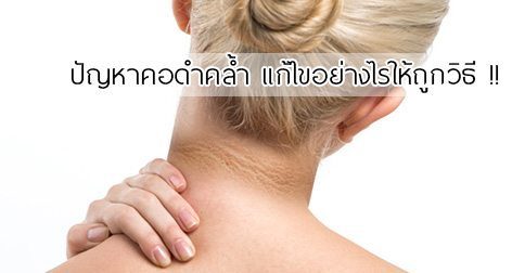 13 วิธีแก้คอดำ ! มีปัญหาคอดำทำไงดี ??
