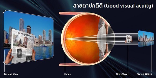 สายตาปกติ