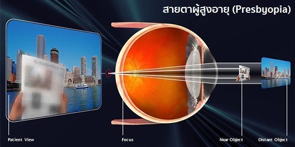 สายตาผู้สูงอายุ
