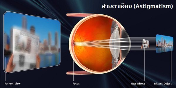 สายตาเอียง
