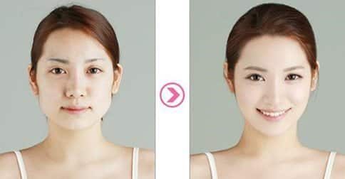 วิธีทําให้หน้าเรียว 16 วิธี ! (ทำหน้าเรียวอย่างเห็นผลปลอดภัย 100%)