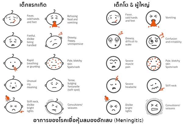 อาการเยื่อหุ้มสมองอักเสบ