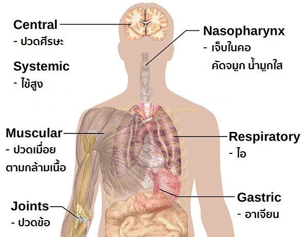 อาการไข้หวัดใหญ่