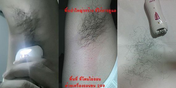 เครื่องถอนขนรักแร้