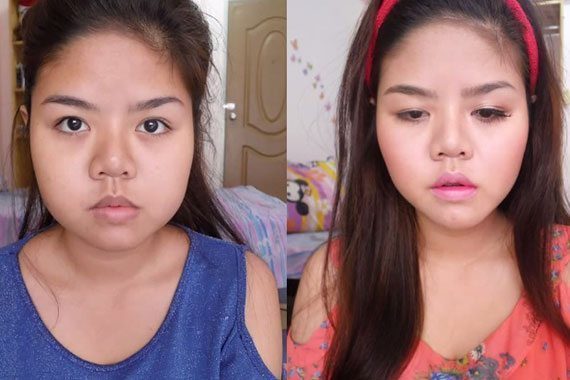 เมโสลดแก้ม
