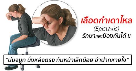เลือดกำเดา (Epistaxis) อาการ สาเหตุ และการรักษาเลือดกำเดาไหล 10 วิธี !!