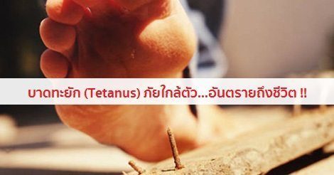 บาดทะยัก อาการ สาเหตุ และการรักษาโรคบาดทะยัก 5 วิธี !!