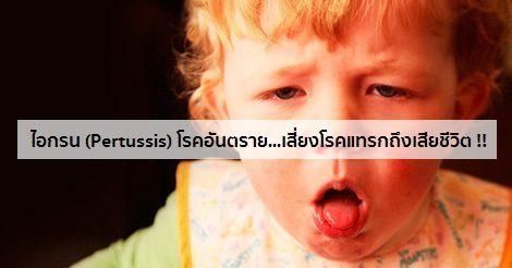 ไอกรน (Pertussis) อาการ สาเหตุ และการรักษาโรคไอกรน 10 วิธี !!