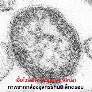 ไวรัสหัด