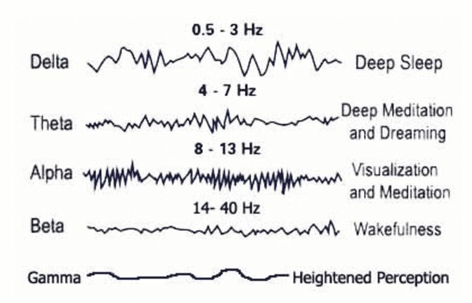 Electroencephalography.png