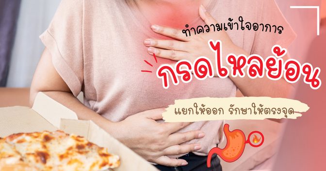 การรักษาโรคกรดไหลย้อน