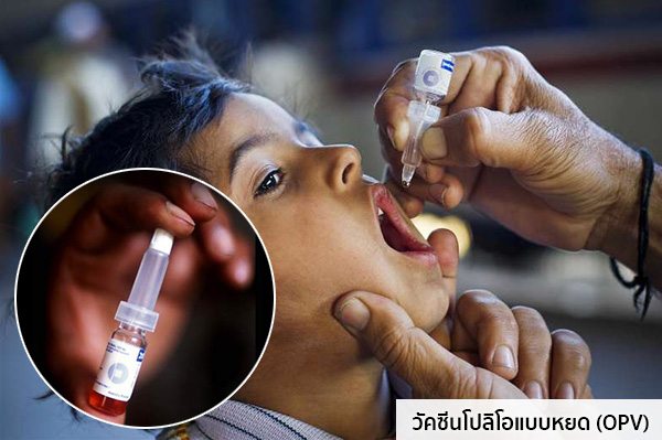 วัคซีนโปลิโอแบบหยด (OPV)