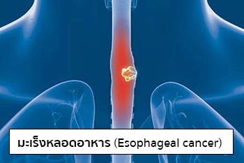 IMAGE SOURCE : www.moderncancerhospital.com.my