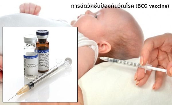 วัคซีนวัณโรค