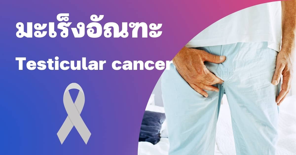 มะเร็งอัณฑะ (Testicular cancer) อาการ, สาเหตุ, การรักษา ฯลฯ
