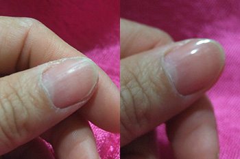 วิธีทำให้เล็บใส