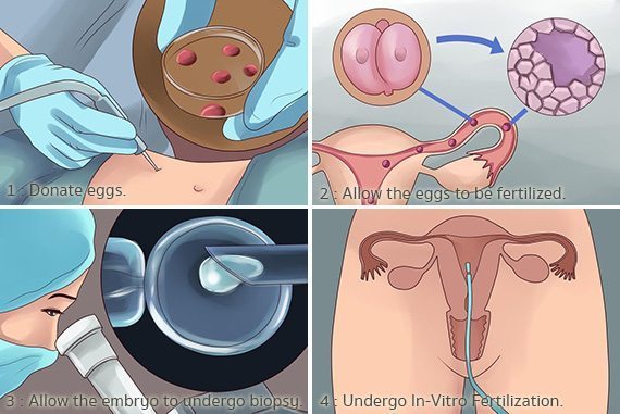 การกำหนดเพศของลูก