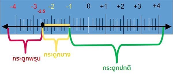 สาเหตุของโรคกระดูกพรุน