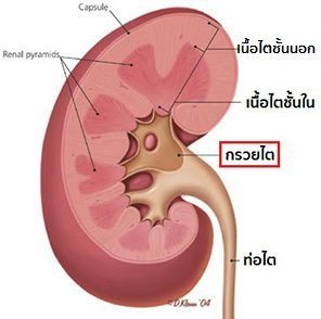 อาการกรวยไตอักเสบ