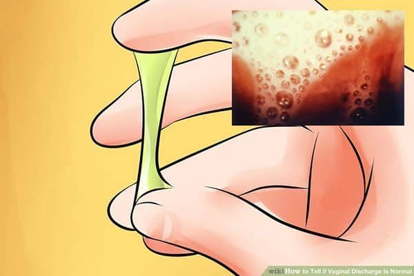 ตกขาวจากเชื้อโปรโตซัว