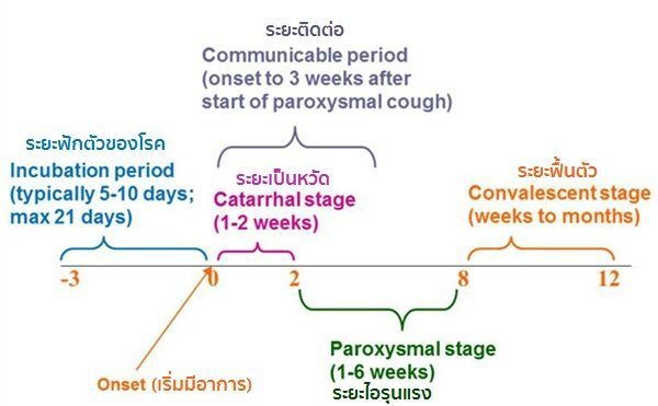 ไอกรน pertussis
