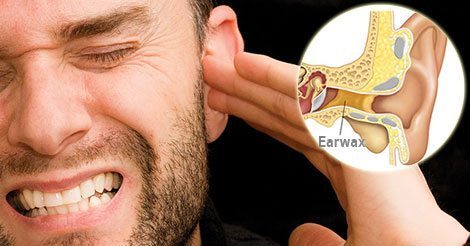 ขี้หูอุดตัน อาการ สาเหตุ และการรักษาขี้หูอุดตันรูหู 5 วิธี !!