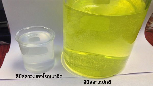 เบาจืดคืออะไร