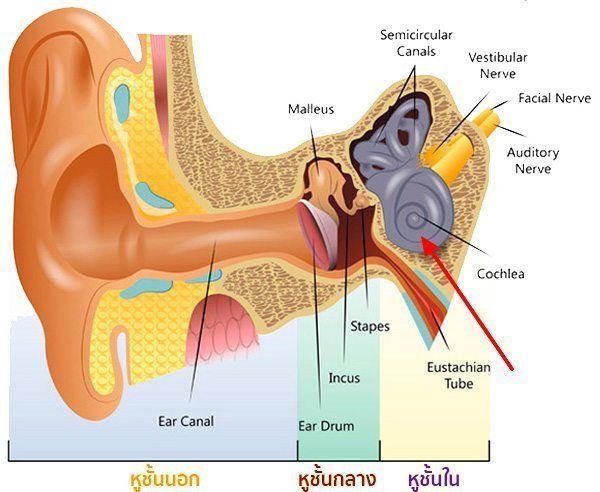 โรคน้ำในหูไม่เท่ากัน