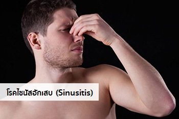 ไซนัสอักเสบ
