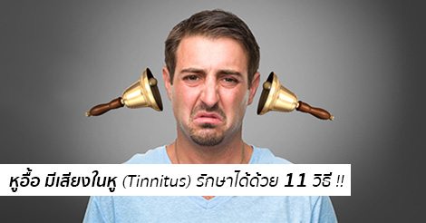 หูอื้อ มีเสียงในหู (Tinnitus) อาการ สาเหตุ และการรักษาหูอื้อ 11 วิธี !!