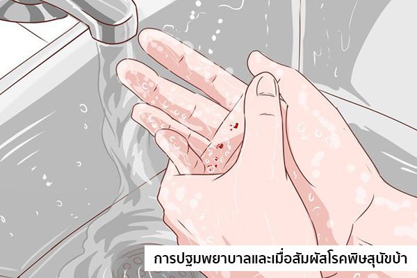 การปฐมพยาบาลโรคพิษสุนัขบ้า