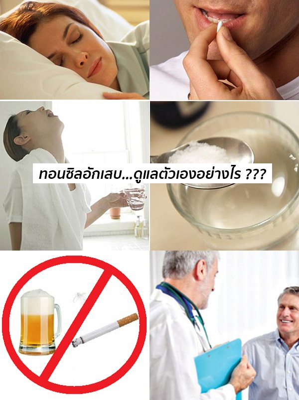 วิธีรักษาต่อมทอนซิลอักเสบ
